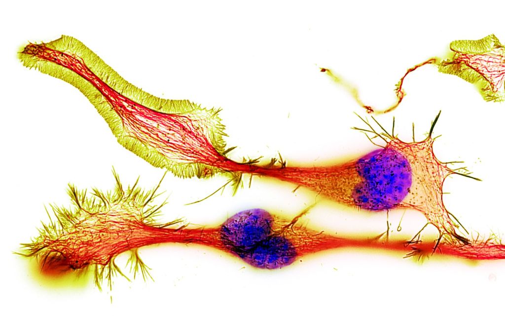 Microfotografia de les cèl·lules neuronals amb les seves terminals sinàptiques. Font: Purkinje (NIGMS)