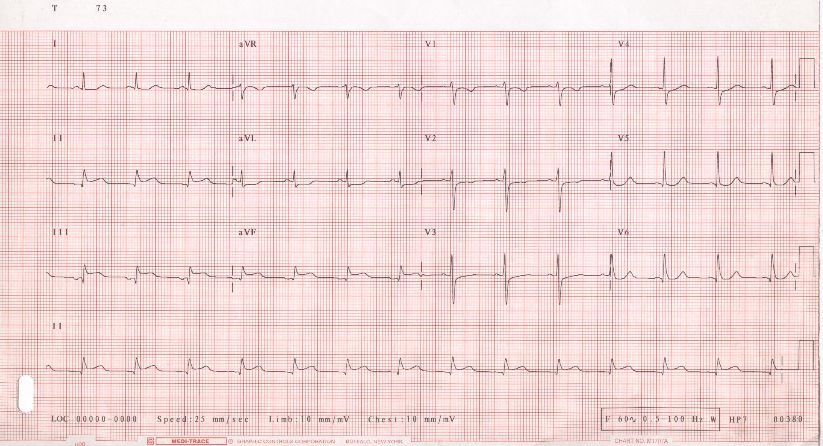 electrocardiograma.jpg electrocardiograma.jpg