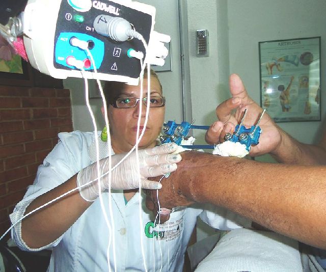 electromiografia.jpg electromiografia.jpg