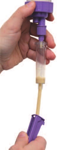 Purgar el sistema obrint el regulador per permetre el pas del preparat fins al final del sistema d'administració/-140 Purgar el sistema obrint el regulador per permetre el pas del preparat fins al final del sistema d'administració/-140