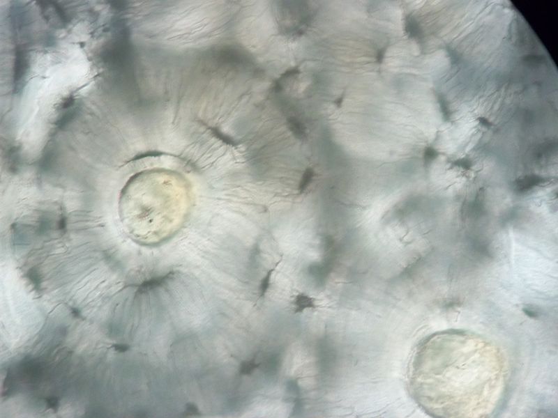 Tall microscòpic de l'os. Font: Wikimedia