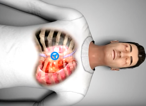 Posició on s'ha de posar el taló de la mà per fer RCP