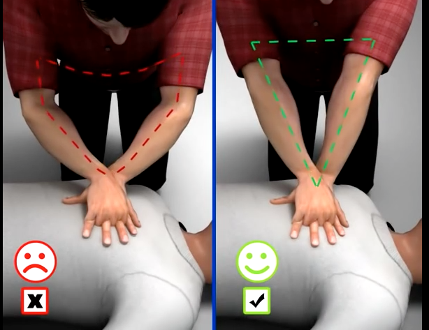 posició braços correcte