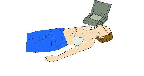 Exemple de posició dels elèctrodes DEA respecte a la víctima.