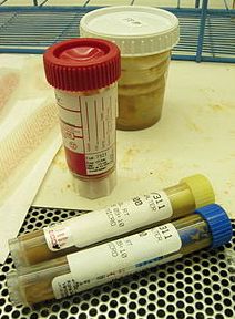 Mitjans de transport per a mostres de femta/-65