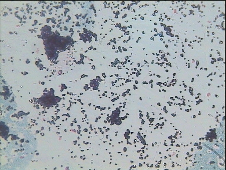 Bacils grampositius/-55