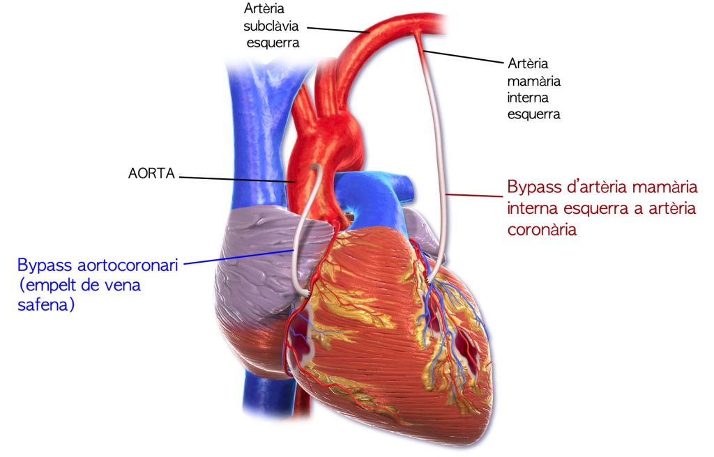 Font: Wikimedia Commons, modificada.