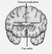 Divisió del cervell als dos hemisferis. Imatge dels hemisferis cerebrals vistos des de dalt, on es pot observar la cissura longitudinal, i en un tall sagital, on s& 039;observa el cos callós.