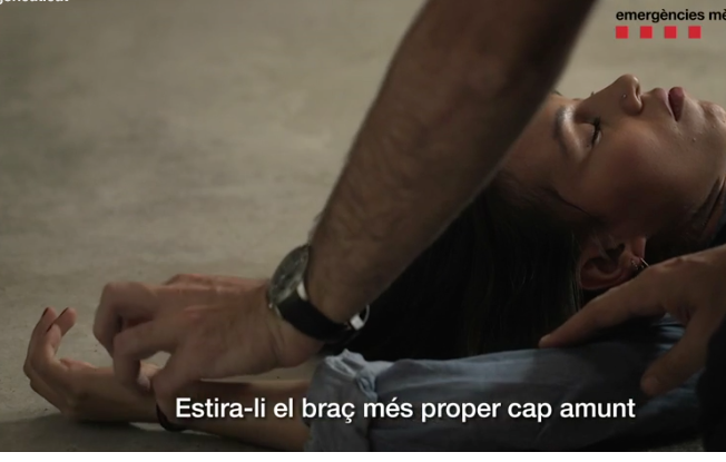 braç en angle recte.SEM