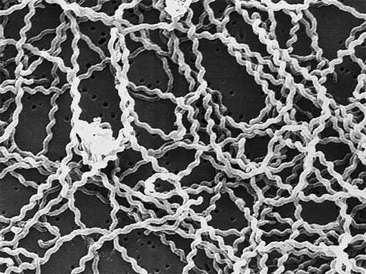 Leptospira, bacteri aerobi causant de la malaltia de Weil, que provoca una forta icterícia, mal de cap, calfreds i anèmia./-5 Leptospira, bacteri aerobi causant de la malaltia de Weil, que provoca una forta icterícia, mal de cap, calfreds i anèmia./-5