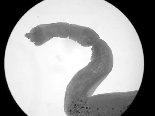 Echinococcus granulosus, cuc de la hiatidosi, que és un endoparàsit del tub digestiu del vertebrats, entre ells l'home. Echinococcus granulosus, cuc de la hiatidosi, que és un endoparàsit del tub digestiu del vertebrats, entre ells l'home.