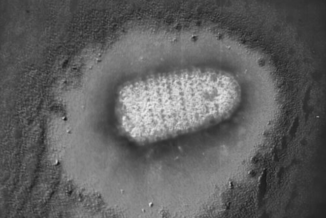 Virus de la ràbia, malaltia causada per unrhabdovirus, que es transmet per la saliva, per vectors com: gossos, gats. ratpenats. etc. Virus de la ràbia, malaltia causada per unrhabdovirus, que es transmet per la saliva, per vectors com: gossos, gats. ratpenats. etc.