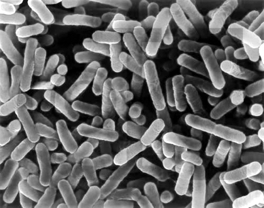Legionella pneumophila, bacteri gram negatiu que necessita oxigen per respirar, té forma de bacil, viu en aigües estancades i és el causant de la legionel·losi./-20 Legionella pneumophila, bacteri gram negatiu que necessita oxigen per respirar, té forma de bacil, viu en aigües estancades i és el causant de la legionel·losi./-20